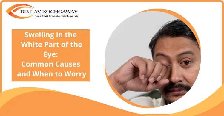 Swelling in the White Part of the Eye: Common Causes and When to Worry